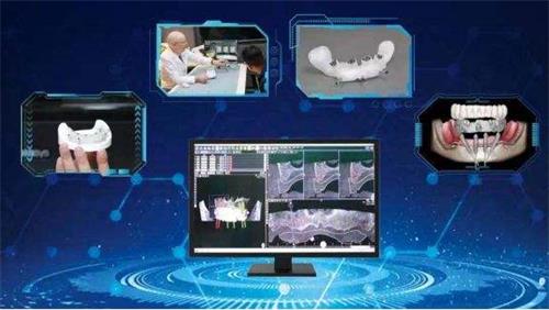 口腔種植手術(shù)導(dǎo)航定位系統(tǒng)同品種臨床評價(jià)注冊審查指導(dǎo)原則（2021年第93號(hào)）(圖1)
