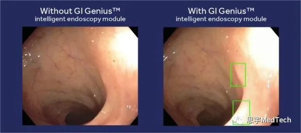 2024全球醫(yī)療科技行業(yè)十大熱點(diǎn)(圖14) 2024全球醫(yī)療科技行業(yè)十大熱點(diǎn)(圖14)